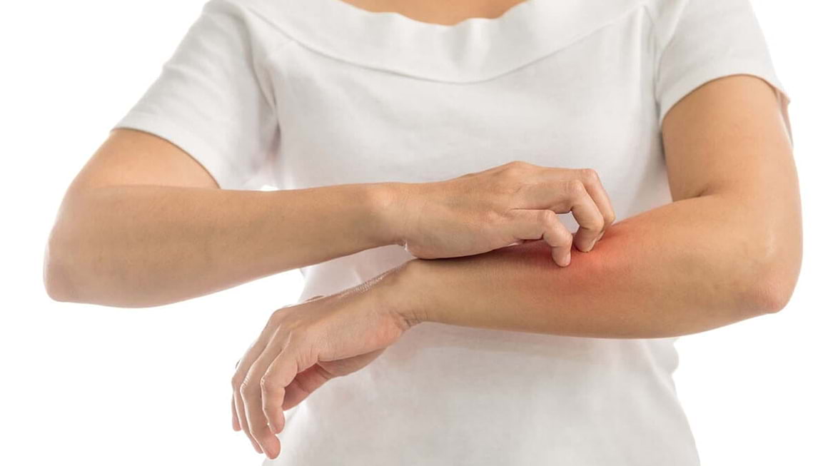 Cele mai comune alergii: 5 factori declansatori